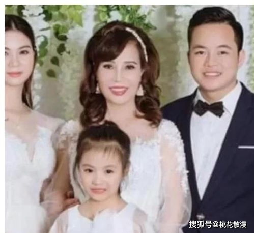 六旬老太太想整成赵雅芝,整容前后对比让人啼笑皆非,相似度为零
